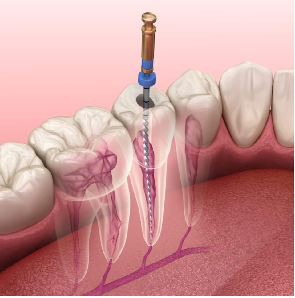 92f93721-6da6-4051-b154-87d96cfc8f3d 92f93721 6da6 4051 B154 87d96cfc8f3d