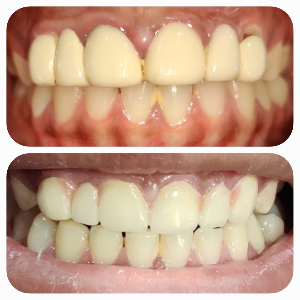 1000028471 1000028471