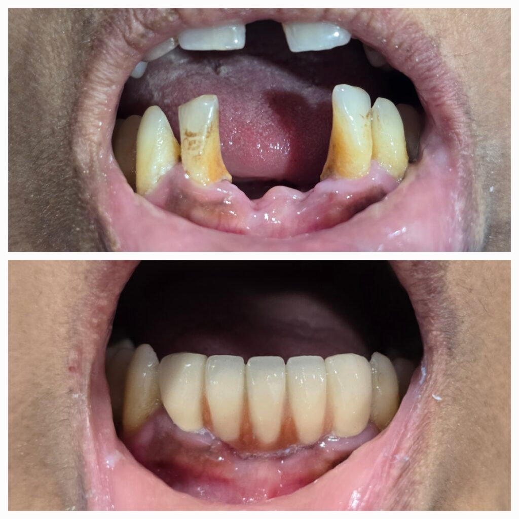 1000111251 (1) 1000111251 (1)